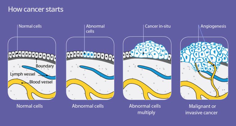 What To Do If Someone Close To You Gets Diagnosed With Cancer