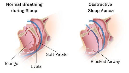 10 Methods You Can Use To Overcome Insomnia