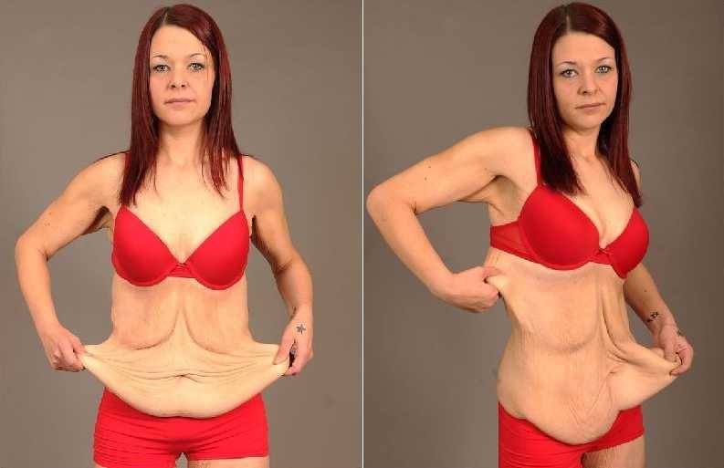 8 Essential Tips For Girls Who Are Fat