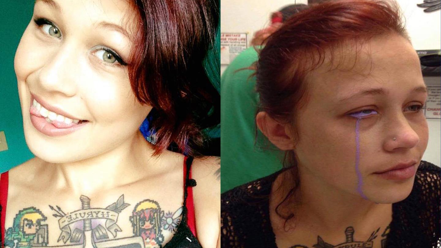 “Model” Lets Boyfriend Of One Month Tattoo Her Eyeball, May Go Blind