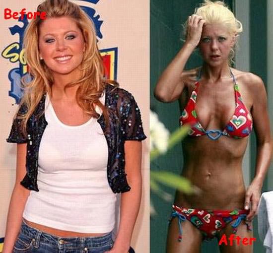 30 Beautiful Women Who Became Ugly