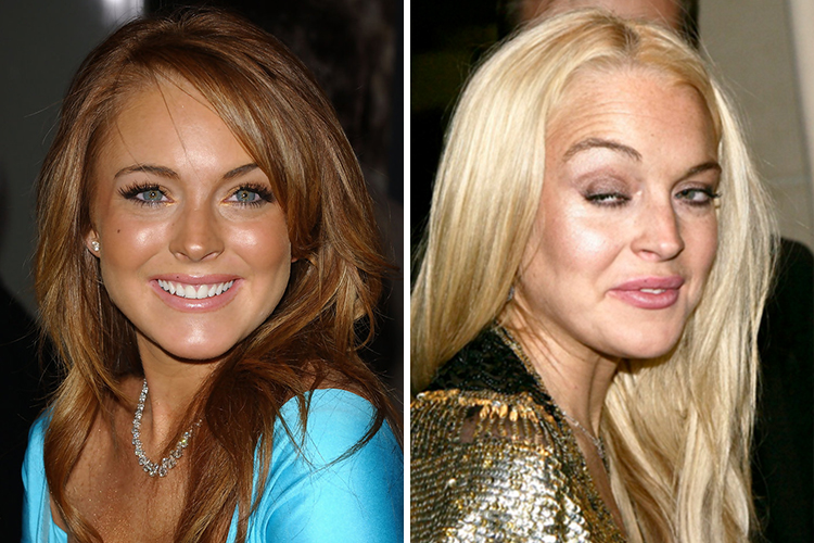 30 Beautiful Women Who Became Ugly