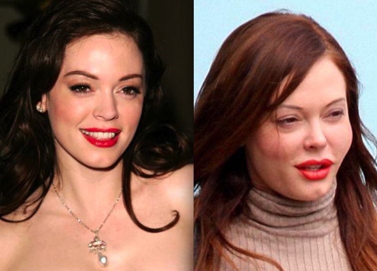 30 Beautiful Women Who Became Ugly