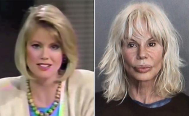 30 Beautiful Women Who Became Ugly