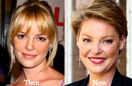 30 Beautiful Women Who Became Ugly