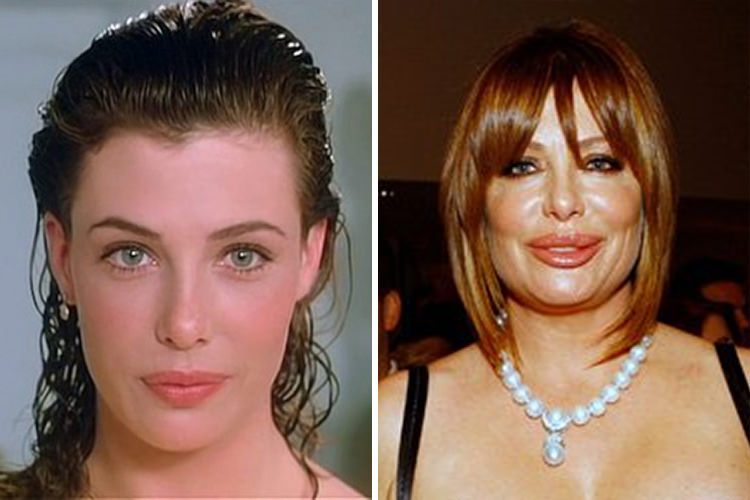 30 Beautiful Women Who Became Ugly