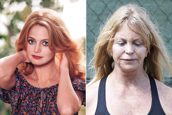 30 Beautiful Women Who Became Ugly
