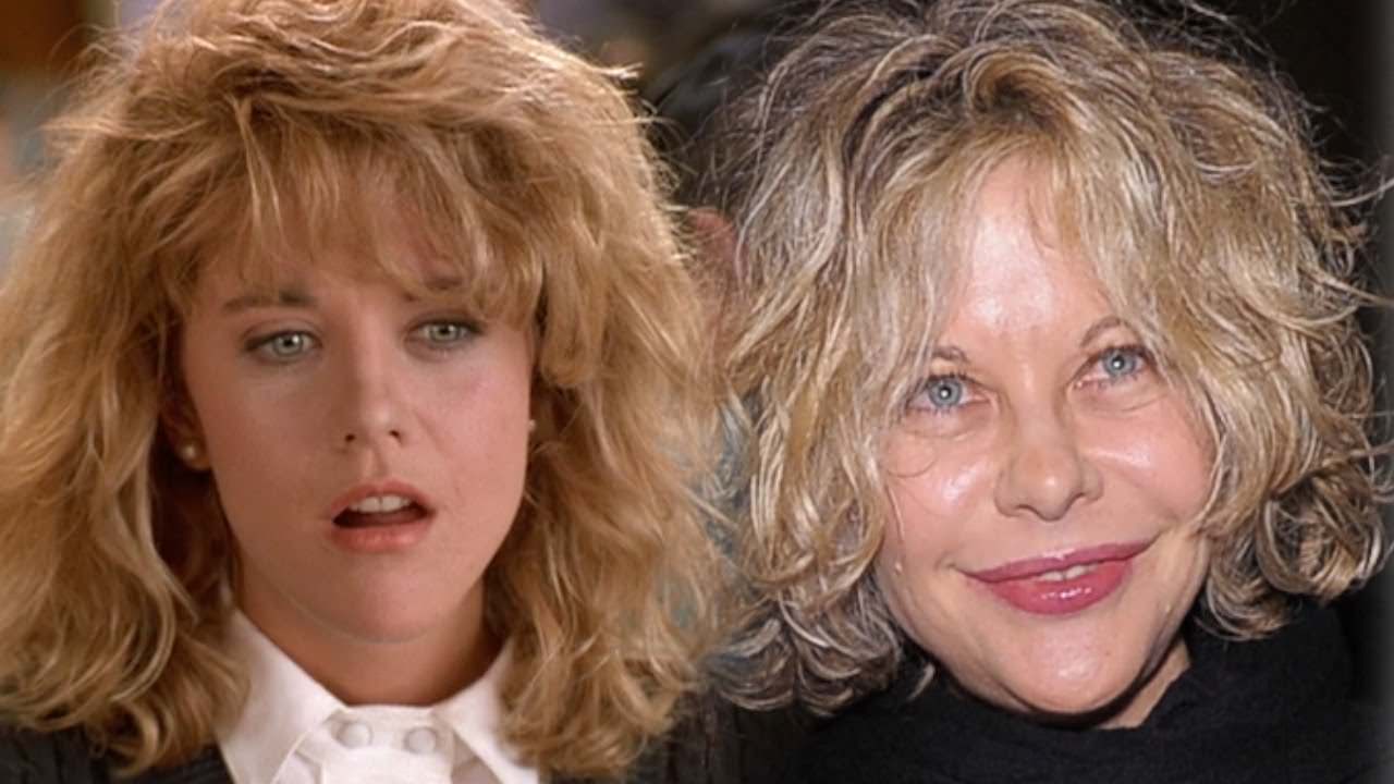 30 Beautiful Women Who Became Ugly