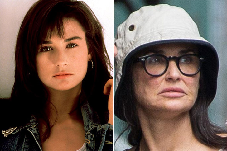 30 Beautiful Women Who Became Ugly