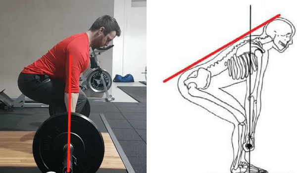 9 Methods To Heal A Damaged Back And Keep It Strong