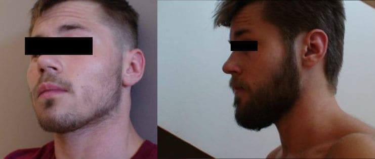 3 Powerful Tips For Optimizing Your Facial Hair