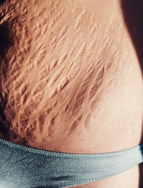 The Real Reason Women Get Abortions